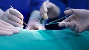 Critical Care Surgical Monitoring