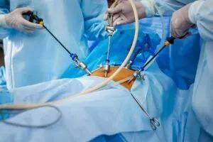 Intraoperative Parameter Monitoring
