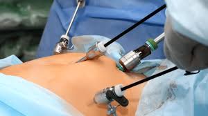 Laparoscopic General Surgical Specialist Team